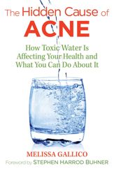 The Hidden Cause of Acne - 8 May 2018