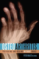 Osteoarthritis - 9 Sep 2010